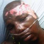 Injured: Darryl Bovell