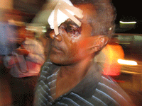 This man suffered injuries to his head and above his right eye