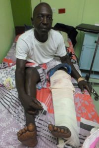Motorcyclist Godfrey Gaim with his injured leg on the hospital bed.