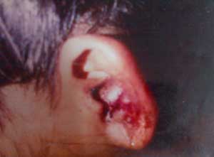 Odessa Seenanan shows lacerations to her left ear, which she said she sustained from her husband during one of the normal beating sessions.