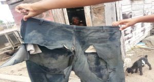 The trousers that this 39-year-old crippled woman was wearing when she was rescued