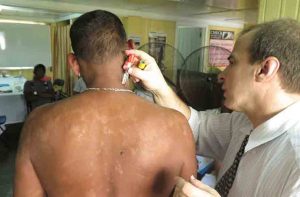 Leprologist Dr. Jaison Barreto of Brazil conducting a Thermal Sensibility Testing on a patient at the Skin Clinic who has both Leprosy and Lota. 