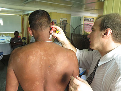Leprologist Dr. Jaison Barreto of Brazil doing a thermal sensation examination of a patient at the Skin Clinic who has Leprosy 