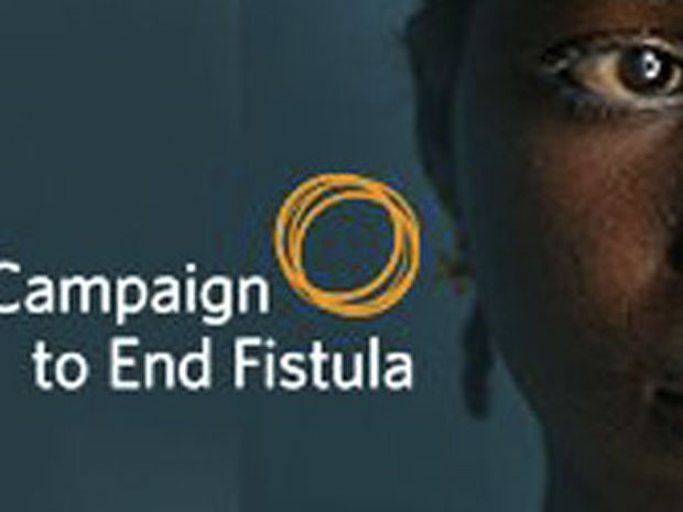 fistula