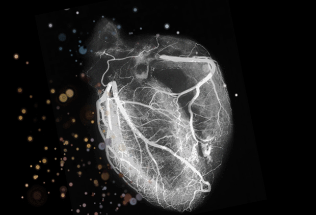 heart-cardiology