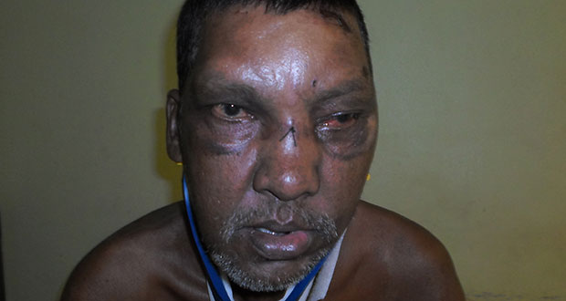 The injured Rajendranauth Gopaul