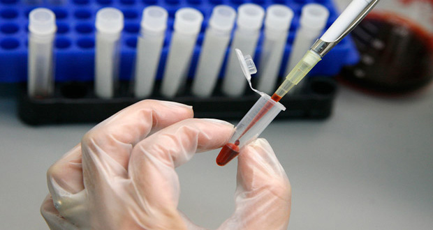 HIV-test-009