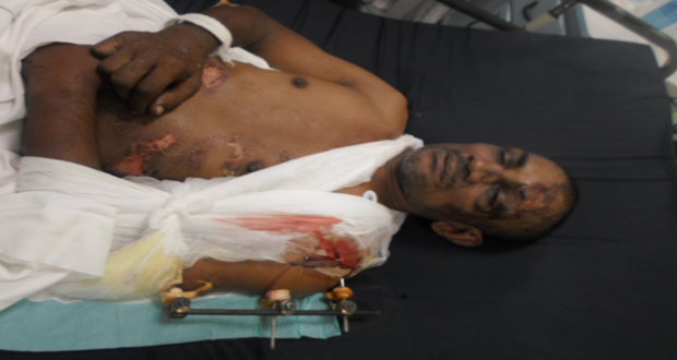 The injured Francis Persaud on a GPHC hospital bed