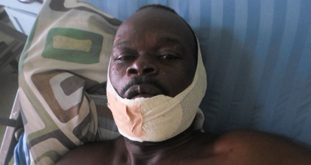 This weeder, Mark Anthony, has been injured in a hit-and-run accident