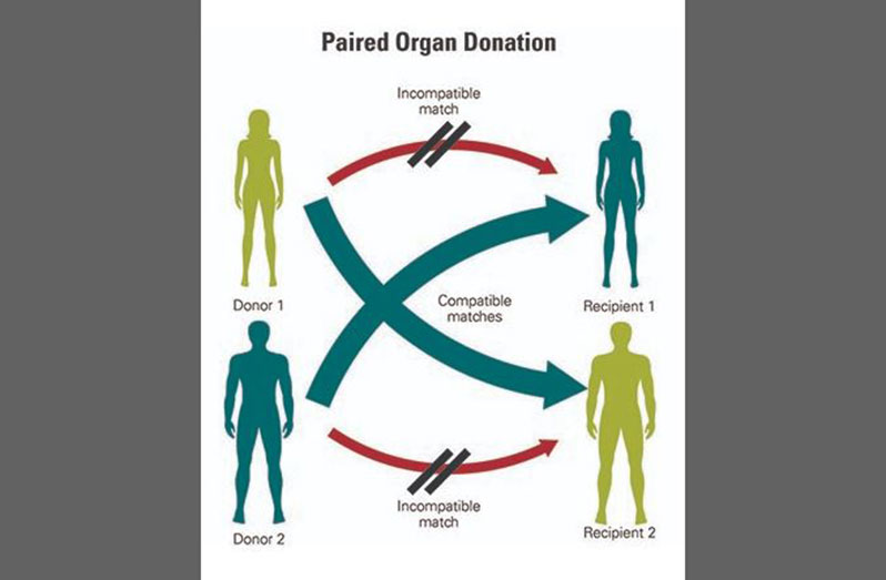 A simple explanation of how paired organ donations work (Photo taken from Nebraska Medicine online)