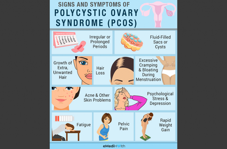 Learning more about Polycystic Ovary Syndrome (PCOS) - Guyana Chronicle