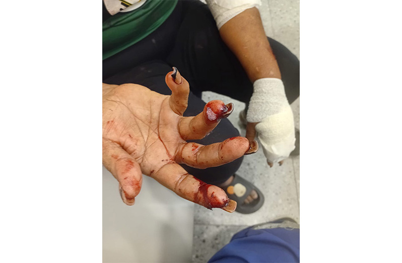 Police probe knife attack on East Bank Demerara family