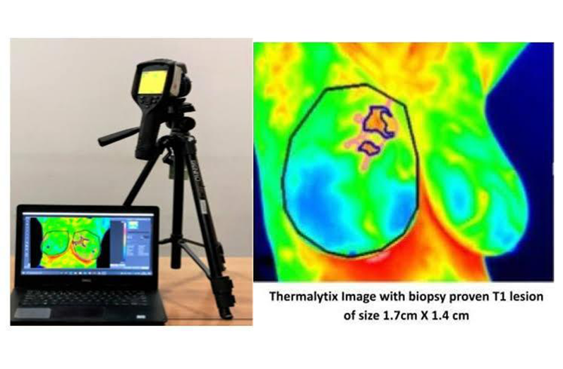 A depiction of the thermography equipment and breast imaging