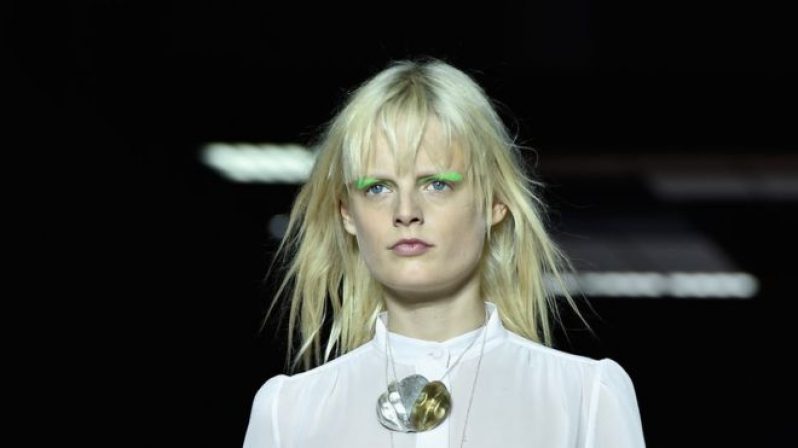 Hanne Gaby Odiele had two major operations, as a child and a teenager