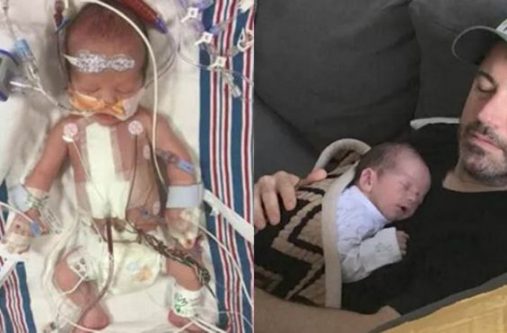 Kimmel shared intimate photos of Billy's first days of life