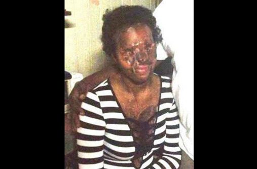 Shondell Williamson after the attack