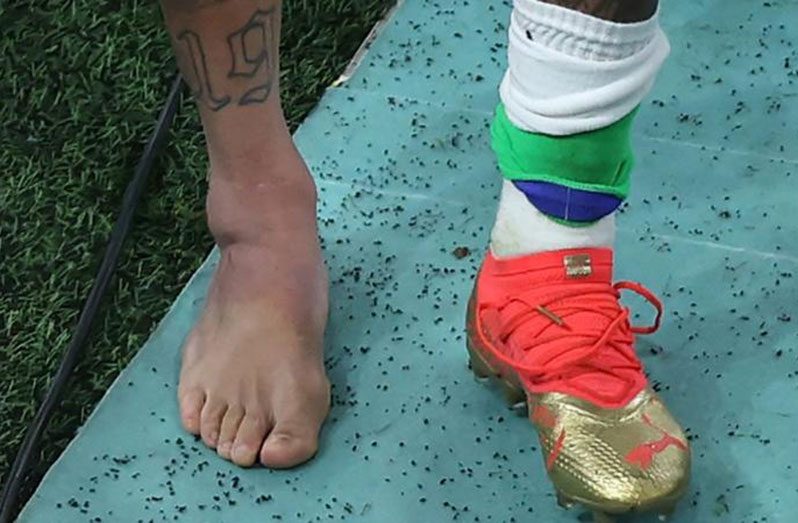 Neymar removed his footwear to display a heavily swollen right ankle after being substituted near the end of Brazil's win over Serbia