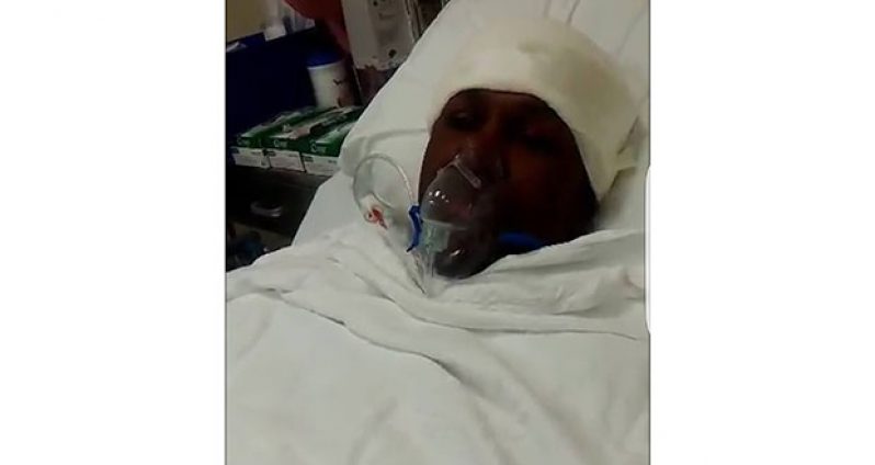 Clive Atwell is seen here after second surgery.