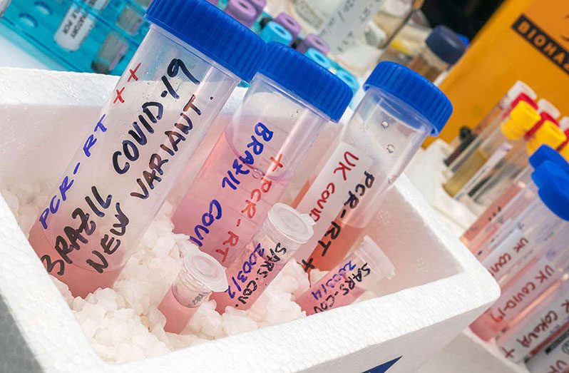 Samples containing the P1 or Brazil variant of the SARS-Cov-2 virus that causes COVID-19 (Felipe Caparros Cruz/Alamy photo)