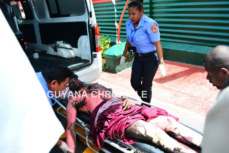 A badly burnt murder and robbery accused Rayon Paddy lays on a stretcher to be taken to the hospital