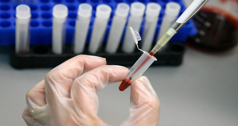 HIV-test-009