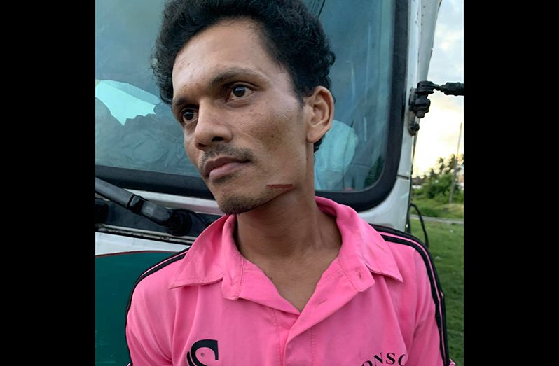 Ravindra Hardyal shows where the bullet grazed him