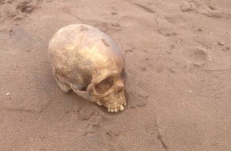human skull