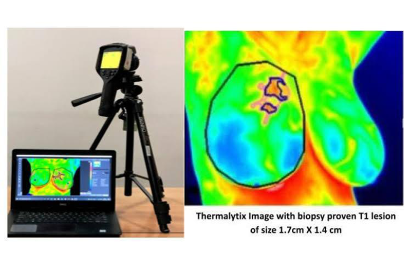 A depiction of the thermography equipment and breast imaging