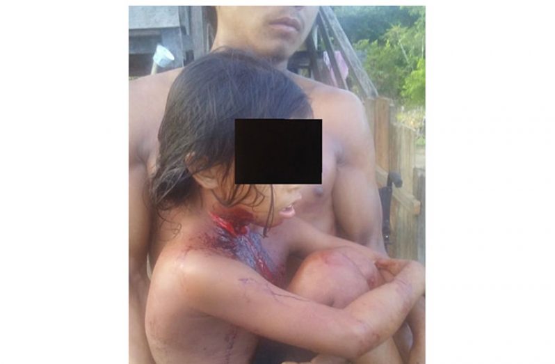 One of the children injured in the stabbing