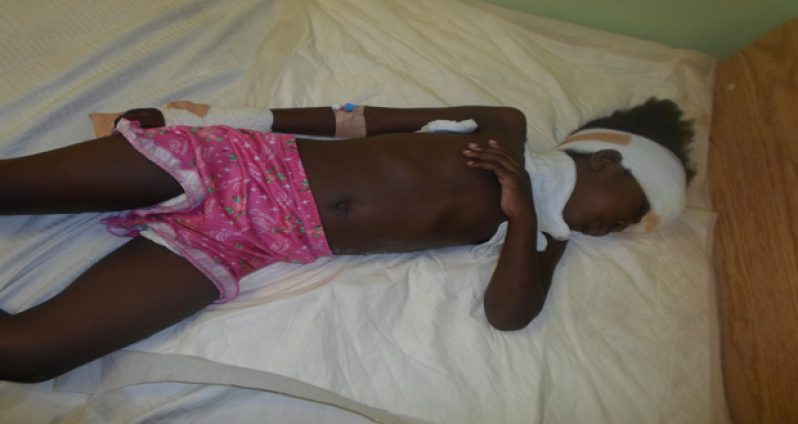 Three-year-old Angel Baynes on her hospital bed after being injured in the accident at Haslington on Sunday