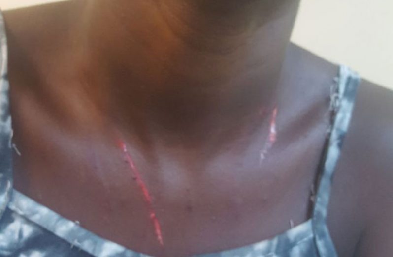 Injuries she received to the neck
