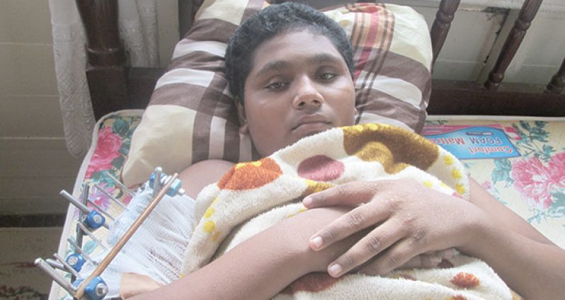 Joshua Lionel is pictured on his bed at his Canje home