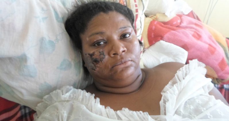 Lucky to be alive: Juliet Payne