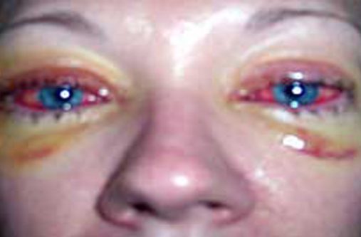 wear just about any desired Halloween Costume, but don’t mess with those eyes. If lost then are not irreplacable