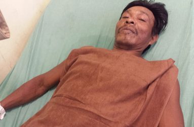 Caire Moses was injured when mining pit wall collapsed at Kaituma Backdam