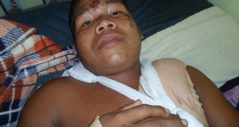 Raphael Fredericks, who was chopped by highway robbers