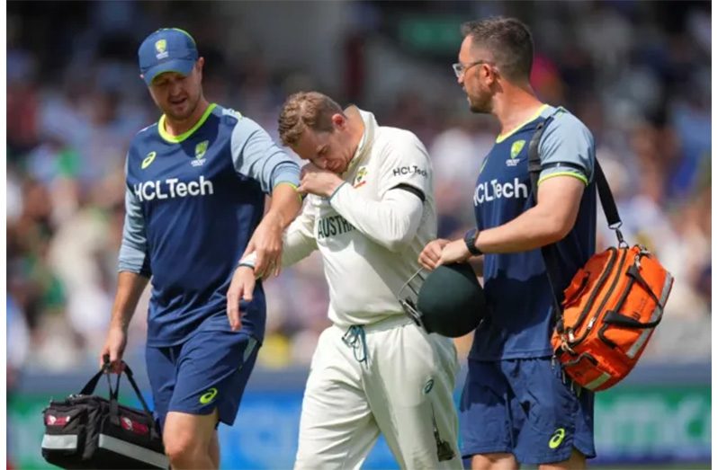 Steven Smith suffered a compound dislocation of the little finger on his right hand and left the field on Day Three of the World Test Championship Final (Photo: Getty Images)