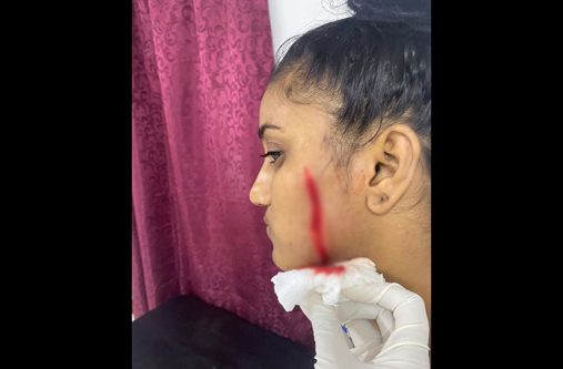 Devi Persaud
