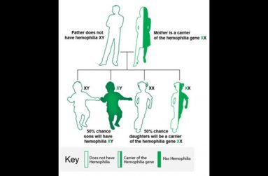 hemophilia-genes