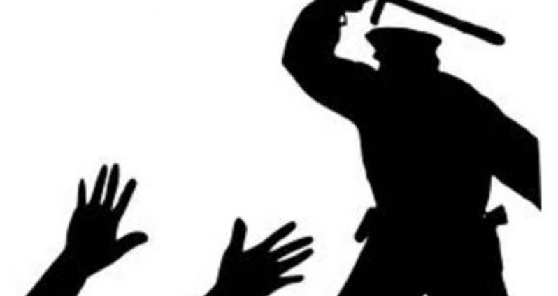 police-brutality