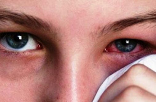 red-eye